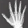 X-ray hand