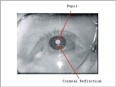 cornea