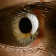 Eye corneal