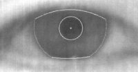 defocus