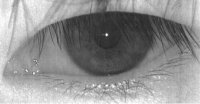 eyelash