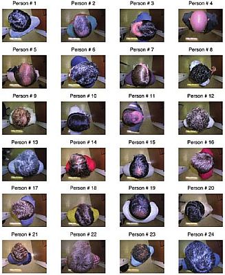 hair sample