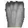 Vein